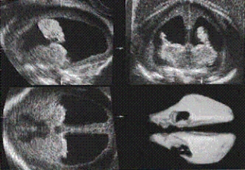 The main anatomy shown on this image is a(n) __________.