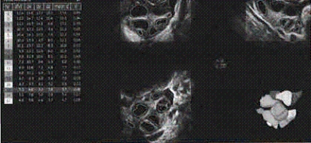 The main anatomy shown on this image is a(n) __________.