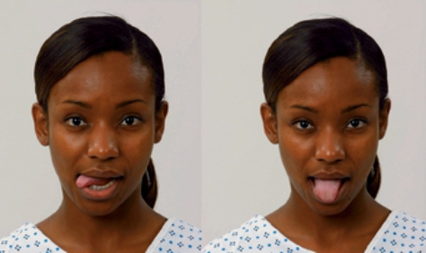 <strong>Based on the client's images, which cranial nerve is being assessed by the demonstrated activity? </strong> A) Trigeminal nerve (cranial nerve V). B) Facial nerve (cranial nerve VII). C) Vagus nerve (cranial nerve X). D) Hypoglossal nerve (cranial nerve XII).