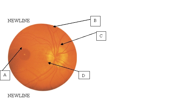 <strong>The nurse is assessing the client's retina. Where is the optic disc located? </strong> A) A. B) B. C) C. D) D.