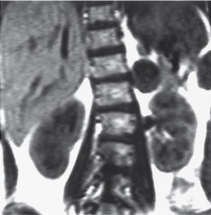 <strong>Which imaging modality provided this image of an endocrine system disorder?  </strong> A) MRI. B) CT. C) Radiography. D) US. <div style=padding-top: 35px> 