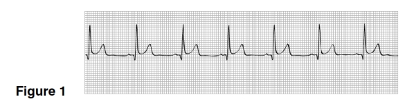The mean rate in Figure 1 is  