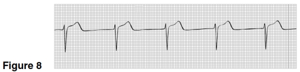 The heart rate in Figure 8 is closest to  