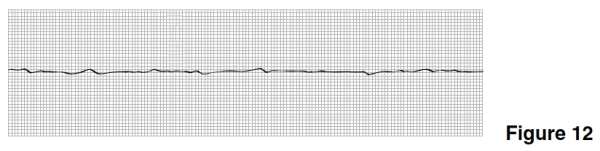 <strong>The rhythm in Figure 12 is </strong> A)P wave asystole. B)Ventricular tachycardia. C)Ventricular fibrillation. D)Paced ventricular rhythm.