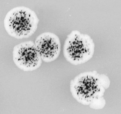 <strong>In the figure shown below, the cause of the appearance of these bacterial colonies is ________ and is caused by ________. </strong> A) sectoring; liver homogenate B) pyrimidine dimers; ultraviolet light C) reversion mutations; rat liver homogenate D) frameshift mutations; high mutation rate E) sectoring; high mutation rate