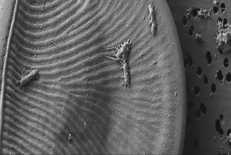 <strong>An association between two Antarctic microorganisms is pictured below. It provides an interaction that supplies ________, made by the ________, to the ________. </strong> A) amino acids; diatom; bacterium B) fixed nitrogen; diatom; bacterium C) fixed nitrogen; bacterium; diatom D) vitamin B12; diatom; bacterium E) vitamin B12; bacterium; diatom