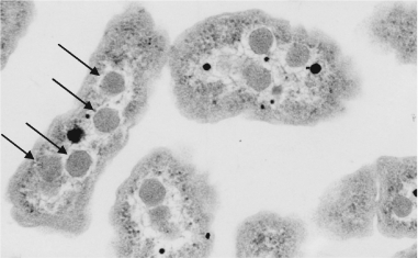 <strong>The structures marked with arrows in the photo below are ________ and are used to ________. </strong> A) polyhydroxyalkanoates; sequester reactions using bicarbonate or carbon dioxide and Rubisco B) polyhydroxyalkanoates; store carbon for energy C) carboxysomes; store carbon for energy D) carboxysomes; sequester reactions using bicarbonate or carbon dioxide and Rubisco E) heterocysts; sequester reactions using bicarbonate or carbon dioxide and Rubisco