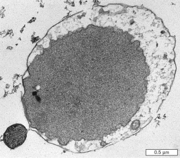 <strong>The exceptionally small cell in the image shown below is an obligate symbiont to another archaeon and a member of the genus </strong> A) Archaeoglobus. B) Ignicoccus. C) Pyrococcus. D) Ferroplasma. E) Nanoarchaeum.