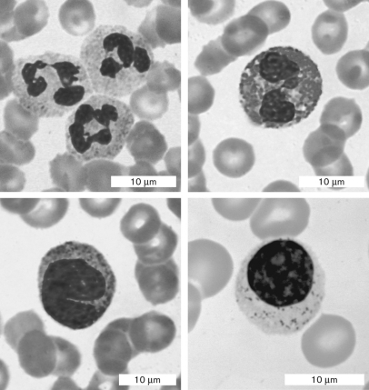 <strong>Which structure engulfs microbes by phagocytosis? </strong> A) hair follicle B) sebaceous gland C) blood vessels D) sweat glands E) subcutaneous tissue