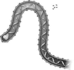 <strong>What virus is shown in the figure below? </strong> A) HIV B) MRSA C) Ebola D) influenza E) rhinovirus