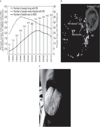 Using the following figures, interpret what is occurring in Figure C.