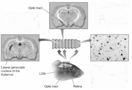 <strong> This illustration demonstrates the use of</strong> A) the Golgi stain. B) the horseradish peroxidase stain. C) microdialysis. D) magnetoencephalography.