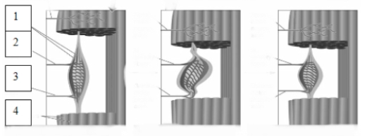 <strong> The structure indicated by the number 2 in this image is known as a(n)</strong> A) extrafusal fiber. B) Ia sensory fiber. C) gamma motor fiber. D) intrafusal fiber.