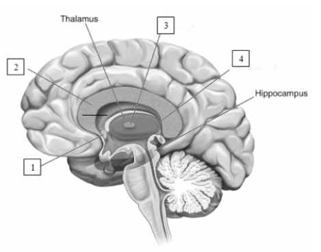 <strong> The structure indicated by the number 2 in this illustration is the</strong> A) corpus callosum. B) massa intermedia. C) anterior commissure. D) hippocampal commissure.
