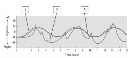 <strong> In this illustration of eye movements during the tracking of a visual stimulus,which of these lines depicts the tracking movements shown by many people with schizophrenia and their relatives?</strong> A) Line number 1 B) Line number 2 C) Line number 3 D) None of the lines.People with schizophrenia and many of their relatives are unable to perform this task.
