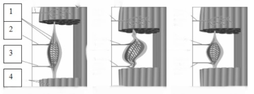 <strong> The structure indicated by the number 2 in this image is known as a(n) </strong> A)extrafusal fiber. B)Ia sensory fiber. C)gamma motor fiber. D)intrafusal fiber.