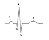 <strong>Figure 44.1   On the ECG above,which waveform represents electrical activity within the atria?</strong> A)1 B)2 C)3 <div style=padding-top: 35px> 