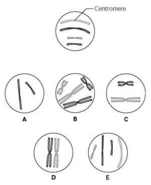 <strong>Use the following information to answer the question(s) below. The unlettered circle at the top of the accompanying figure shows a diploid nucleus with four chromosomes that have not yet replicated. There are two pairs of homologous chromosomes, one long and the other short. One haploid set is black, and the other is gray. The circles labeled A to E show various combinations of these chromosomes. What is the correct chromosomal condition for one daughter nucleus at telophase of mitosis?</strong> A) A B) B C) C D) D E) E