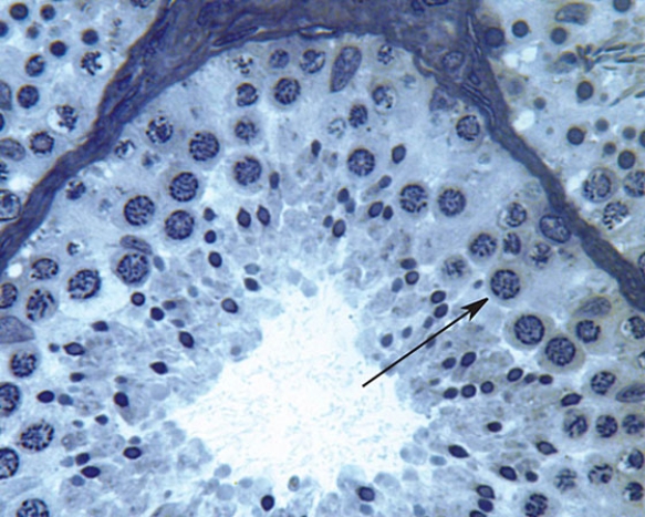 <strong>Identify the cell at the tip of the arrow </strong> A) spermatogonia A B) spermatogonia B C) primary spermatocyte D) secondary spermatocyte E) spermatid
