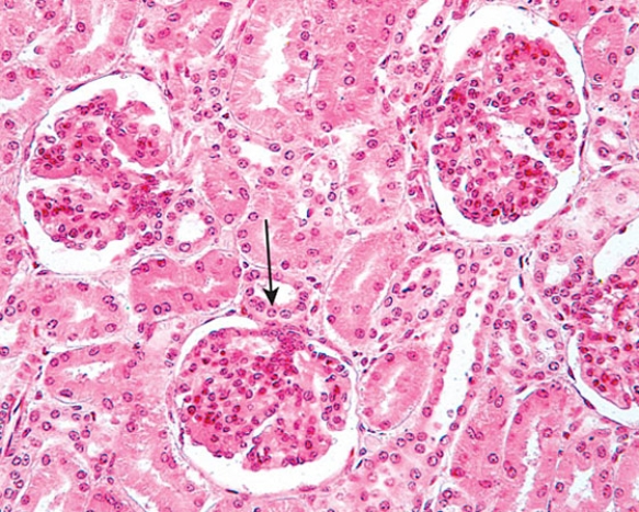 <strong>The structure at the tip of the arrow  </strong> A) releases renin B) releases angiotensin I C) is a proximal convoluted tubule D) adjoins the afferent glomerular arteriole E) is located at the urinary pole of the renal corpuscle <div style=padding-top: 35px> 