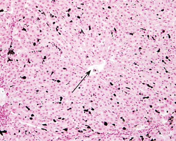 <strong>The tip of the arrow is located in the  </strong> A) space of Disse B) bile duct C) portal area D) central vein E) hepatic sinus <div style=padding-top: 35px> 