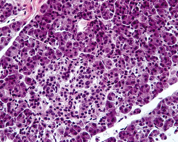 <strong>The tip of the white arrow is pointing to which of the following?  </strong> A) acinar cell B) beta cell C) alpha cell D) centroacinar cell E) delta cell <div style=padding-top: 35px> 
