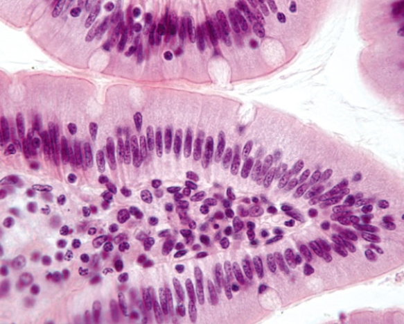 <strong>In Fig. Img_005a, a patient presents with an ulcer.This photomicrograph shows a healthy area of the ulcerated organ. Where is this patient's ulcer located?  </strong> A) esophagus B) fundic stomach C) pyloric stomach D) duodenum E) jejunum <div style=padding-top: 35px> 