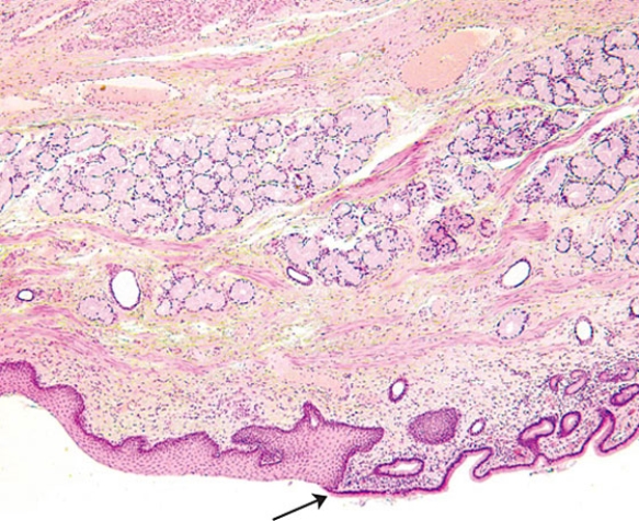 <strong>The tip of the arrow indicates the junction of the  </strong> A) rectum and the anus B) rectum and the colon C) stomach and the duodenum D) stomach and the esophagus E) esophagus and the pharynx <div style=padding-top: 35px> 