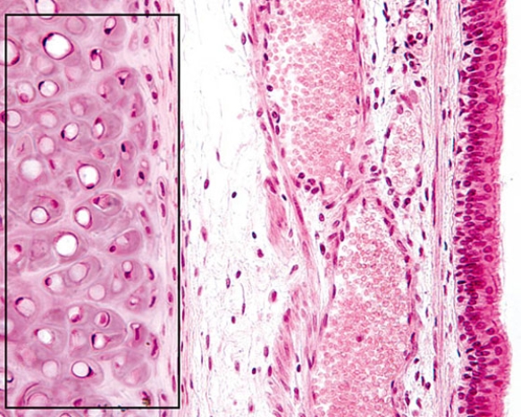 <strong>Identify the structure enclosed in the rectangle  </strong> A) elastic cartilage of the epiglottis B) fibrocartilage of the intervertebral disk C) cartilage plate of a secondary bronchus D) C ring of the trachea E) epiphyseal plate of a growing bone <div style=padding-top: 35px> 