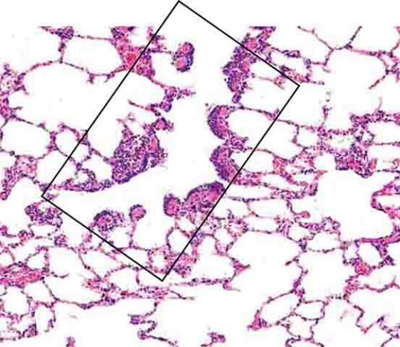 <strong>The region enclosed by the rectangle is a (an)  </strong> A) bronchiole B) terminal bronchiole C) respiratory bronchiole D) alveolar duct E) alveolar sac <div style=padding-top: 35px> 