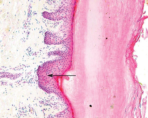 <strong>Identify the layer at the arrow tip </strong> A) stratum basale B) stratum spinosum C) stratum granulosum D) stratum lucidum E) stratum corneum