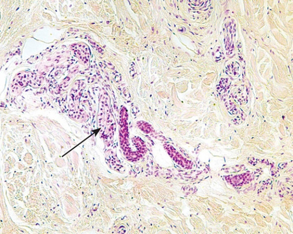 <strong>The structure at the tip of the arrow </strong> A) is a mechanoreceptor B) manufactures sebum C) manufactures a mucous secretion D) manufactures sweat E) is the duct of a sweat gland