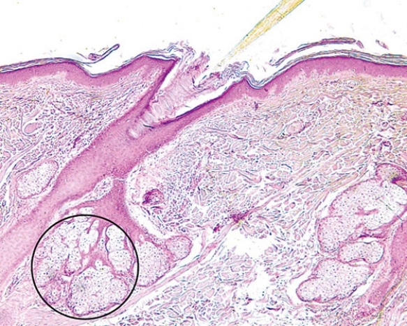 <strong>The encircled structure </strong> A) is a mechanoreceptor B) manufactures sebum C) manufactures a mucous secretion D) manufactures sweat E) is the duct of a sweat gland