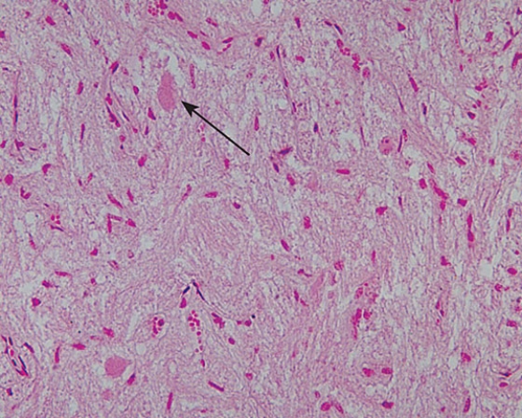 <strong>The structure indicated by the arrow contains which of the following substances?  </strong> A) thyroglobulin B) oxytocin C) triglyceride D) glycogen E) milk <div style=padding-top: 35px> 