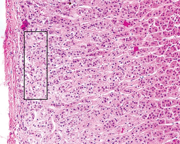 <strong>The region of the organ enclosed by the rectangle produces  </strong> A) androgens B) aldosterone C) melatonin D) adrenocorticotropic hormone (ACTH) E) angiotensin II <div style=padding-top: 35px> 