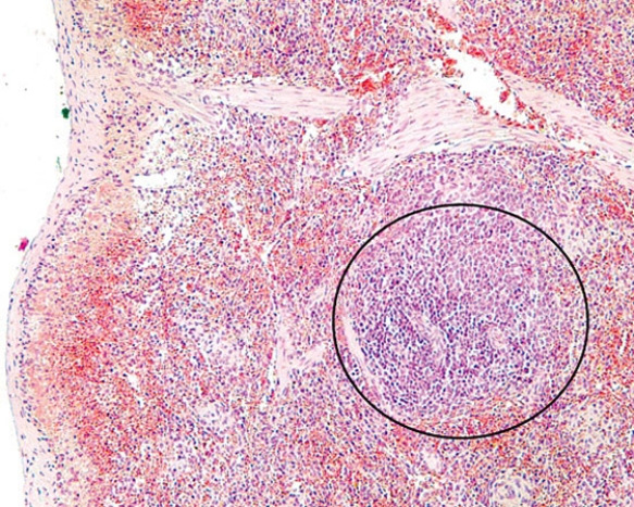 <strong>The region inside the circle is the  </strong> A) cortex of a lymph node B) medulla of a lymph node C) cortex of the thymus D) medulla of the thymus E) white pulp of the spleen <div style=padding-top: 35px> 