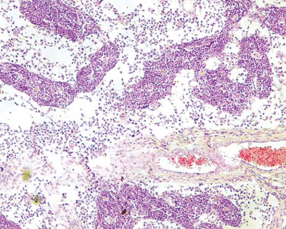 <strong>This photomicrograph represents the  </strong> A) cortex of a lymph node B) medulla of a lymph node C) cortex of the thymus D) medulla of the thymus E) white pulp of the spleen <div style=padding-top: 35px> 