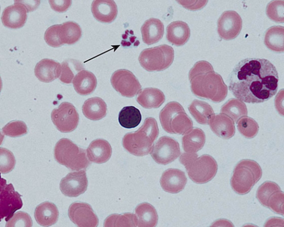 <strong>The structures at the tip of the arrow </strong> A) arise from CFU-GM B) arise from reticulocytes C) house major dense protein D) house \alpha -granules E) release von Willebrand factor