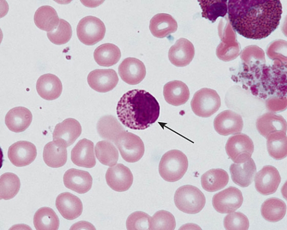 <strong>The cell at the tip of the arrow is a(n) </strong> A) basophilic metamyelocyte B) basophilic myelocyte C) neutrophilic myelocyte D) eosinophilic metamyelocyte E) eosinophilic myelocyte