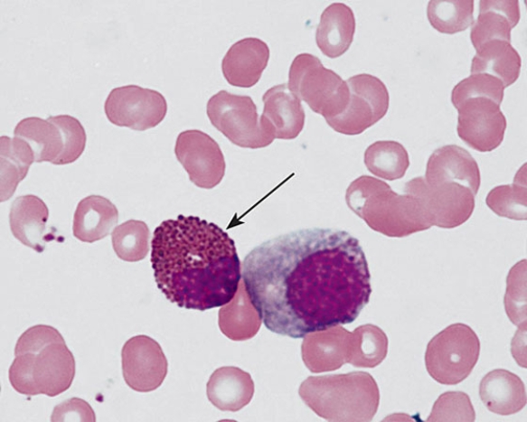 <strong>The cell at the tip of the arrow is a(n) </strong> A) basophilic metamyelocyte B) basophilic myelocyte C) neutrophilic myelocyte D) eosinophilic metamyelocyte E) eosinophilic myelocyte