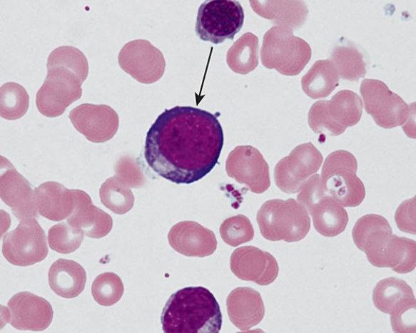 <strong>The cell at the tip of the arrow is a </strong> A) basophilic erythroblast B) myeloblast C) proerythroblast D) promyelocyte E) polychromatophilic erythroblast