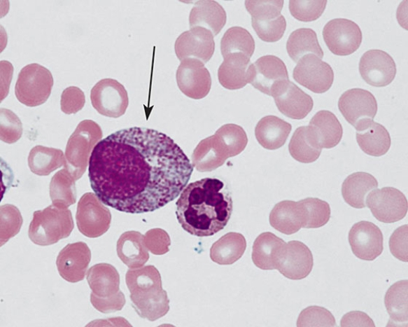 <strong>The cell at the arrow tip is a </strong> A) basophilic erythroblast B) myeloblast C) proerythroblast D) promyelocyte E) polychromatophilic erythroblast