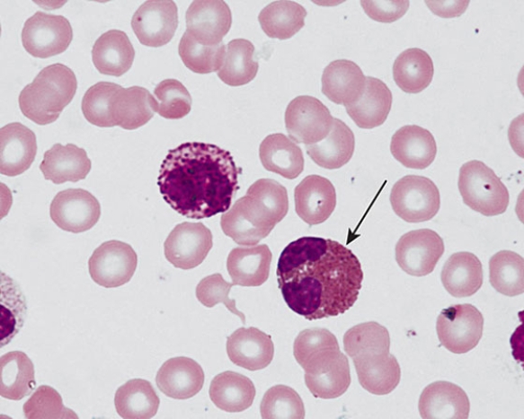 <strong>The cell at the tip of the pointer </strong> A) phagocytoses bacteria B) phagocytoses antigens C) releases major basic protein D) releases eosinophil chemotactic factor E) binds IgE to its plasmalemma