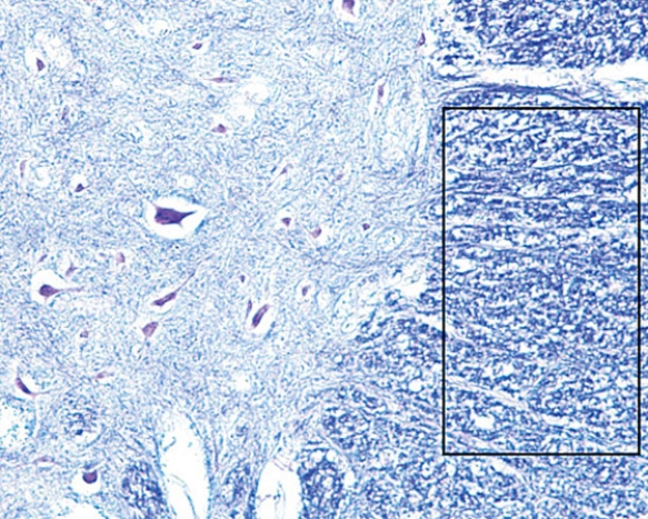<strong>The region within the rectangle is the </strong> A) cerebellar cortex B) cerebellar medulla C) gray matter of the spinal cord D) white matter of the spinal cord E) cerebral cortex