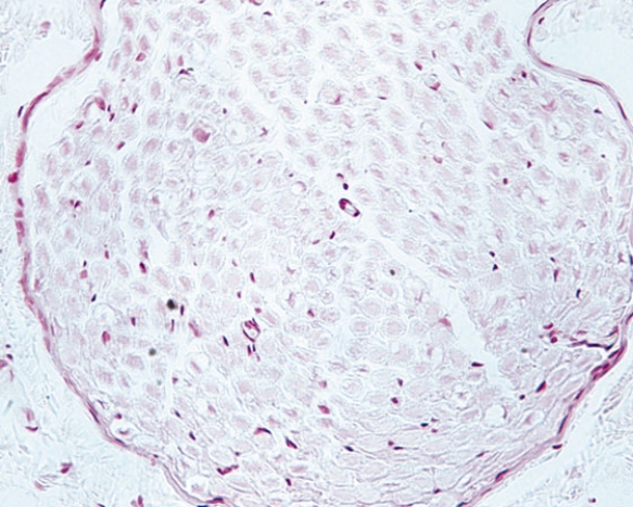 <strong>Identify the structure </strong> A) dorsal root ganglion B) nerve fiber C) adipose tissue D) autonomic ganglion E) embryonic connective tissue