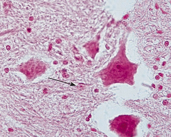 <strong>Identify the cell at the tip of the arrow </strong> A) unipolar neuron B)pseudounipolar neuron C) bipolar neuron D) interneuron E) astrocyte