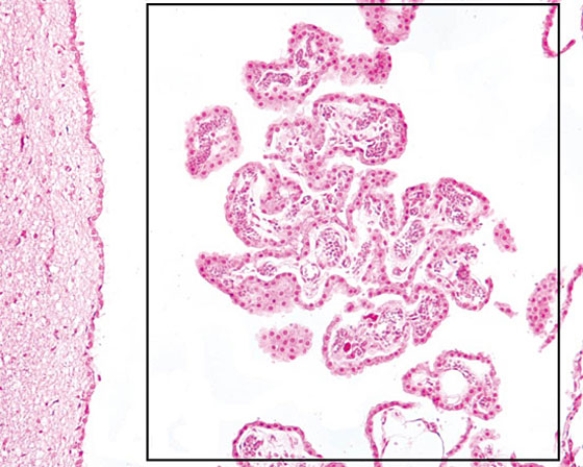 <strong>The structure located in the rectangle is responsible for the </strong> A) formation of cerebrospinal fluid B) elimination of cerebrospinal fluid C) lining of the ventricles of the brain D) lining the central canal of the spinal cord E) formation of new neurons