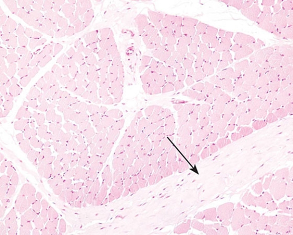 <strong>Identify the structure (clear area) at the tip of the arrow  </strong> A) epineurium B) perineurium C) endomysium D) perimysium E) epimysium <div style=padding-top: 35px> 