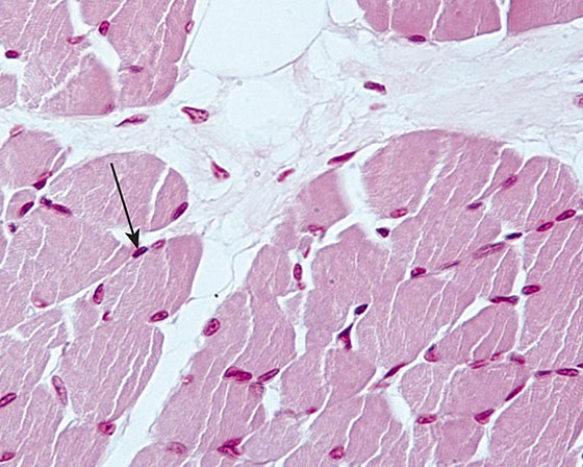 <strong>Identify the cell whose nucleus is at the tip of the arrow  </strong> A) skeletal muscle cell B) adipocyte C) satellite cell D) Schwann cell E) endothelial cell <div style=padding-top: 35px> 