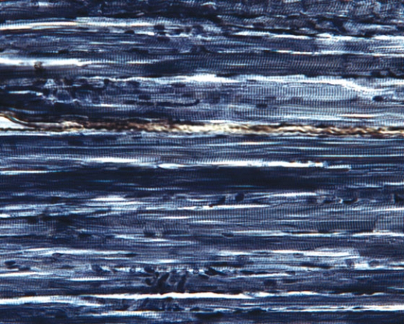 <strong>Identify this tissue  </strong> A) cardiac muscle B) dense regular elastic connective tissue C) dense regular collagenous connective tissue D) skeletal muscle E) elastic cartilage <div style=padding-top: 35px> 